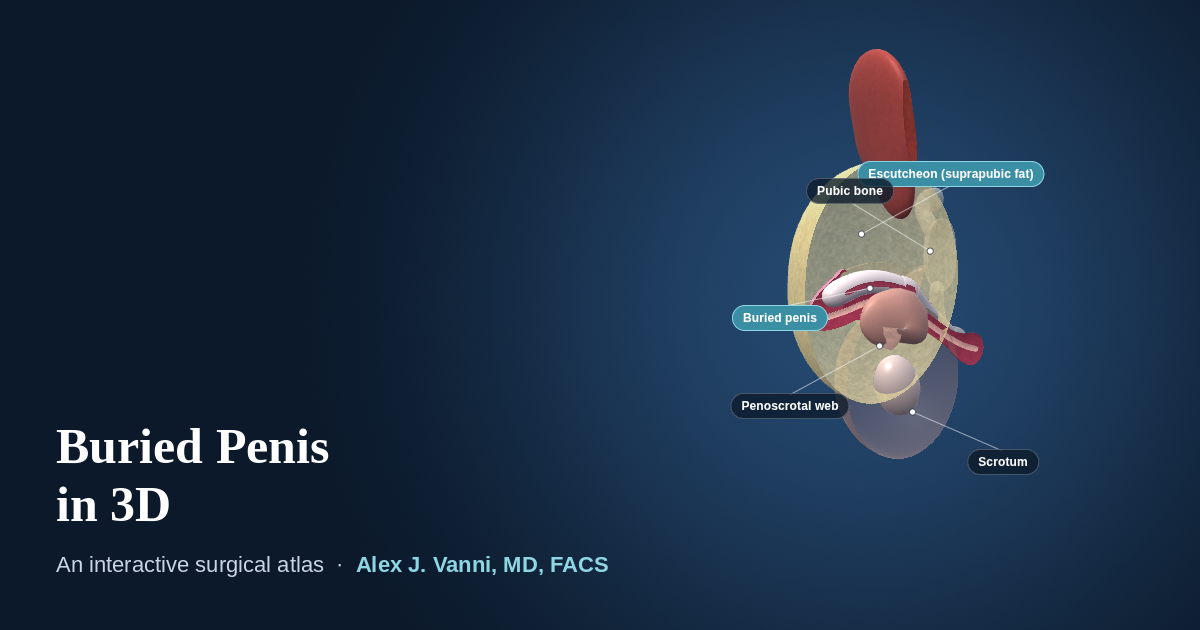 3D cutaway model showing the penis hidden within a thick suprapubic fat pad, with a webbed scrotum