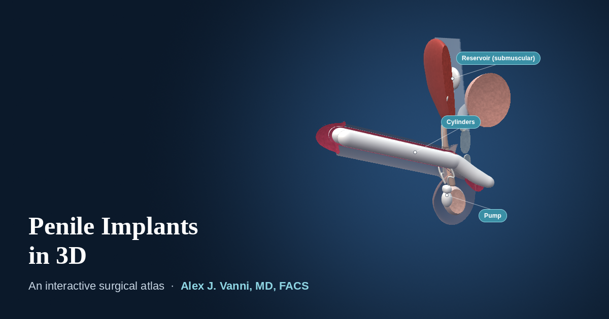 3D model of the penis with an inflatable penile implant: cylinders, scrotal pump and submuscular reservoir